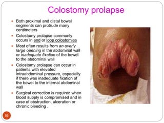 Colostomy prolapse
 Both proximal and distal bowel
segments can protrude many
centimeters
 Colostomy prolapse commonly
occurs in end or loop colostomies
 Most often results from an overly
large opening in the abdominal wall
or inadequate fixation of the bowel
to the abdominal wall
 Colostomy prolapse can occur in
patients with elevated
intraabdominal pressure, especially
if there was inadequate fixation of
the bowel to the internal abdominal
wall
 Surgical correction is required when
blood supply is compromised and in
case of obstruction, ulceration or
chronic bleeding .
58
 