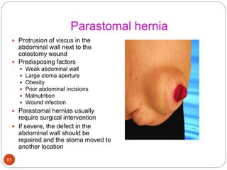 Parastomal hernia
 Protrusion of viscus in the
abdominal wall next to the
colostomy wound
 Predisposing factors
 Weak abdominal wall
 Large stoma aperture
 Obesity
 Prior abdominal incisions
 Malnutrition
 Wound infection
 Parastomal hernias usually
require surgical intervention
 If severe, the defect in the
abdominal wall should be
repaired and the stoma moved to
another location
61
 