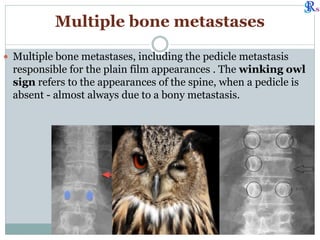 Spine disease rg evaluation.pdf