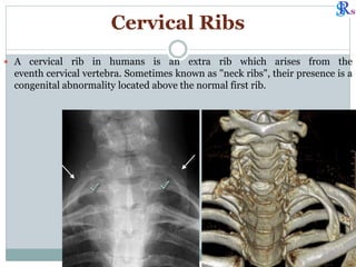 Spine disease rg evaluation.pdf