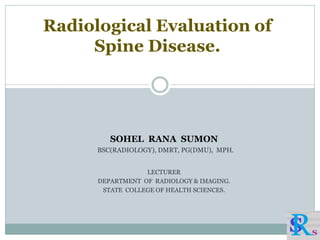 SOHEL RANA SUMON
BSC(RADIOLOGY), DMRT, PG(DMU), MPH.
LECTURER
DEPARTMENT OF RADIOLOGY & IMAGING.
STATE COLLEGE OF HEALTH SCIENCES.
Radiological Evaluation of
Spine Disease.
 