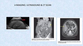 ➢IMAGING: ULTRASOUND & CT SCAN
 