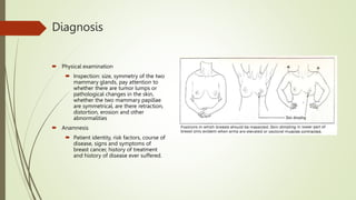 Diagnosis
 Physical examination
 Inspection: size, symmetry of the two
mammary glands, pay attention to
whether there are tumor lumps or
pathological changes in the skin,
whether the two mammary papillae
are symmetrical, are there retraction,
distortion, erosion and other
abnormalities
 Anamnesis
 Patient identity, risk factors, course of
disease, signs and symptoms of
breast cancer, history of treatment
and history of disease ever suffered.
 
