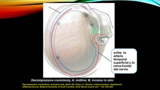 Decompressive craniotomy, A, midline; B, incision in skin
Decompressive craniectomy: technical note, Quinn TM, Taylor JJ; 1Division of Neurosurgery, Department
ofNeurosciences, Medical University of South Carolina; Acta Neurol Scand: 2011: 123: 239–244
evitar la
arteria
temporal
superficial y la
rama frontal
del nervio
 