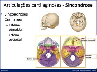 Articulações cartilaginosas - Sincondrose
Prof. Me. André Moreira Rocha
Anatomia
• Sincondroses
Cranianas
– Esfeno-
etmoidal
– Esfeno-
occipital
 