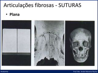 Articulações fibrosas - SUTURAS
Prof. Me. André Moreira Rocha
Anatomia
• Plana
 