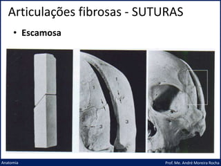 Articulações fibrosas - SUTURAS
Prof. Me. André Moreira Rocha
Anatomia
• Escamosa
 
