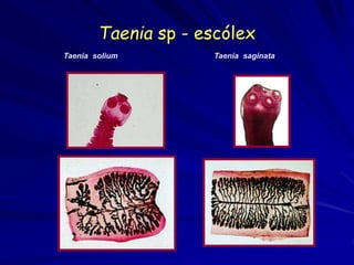 Taenia sp - escólex
Taenia saginata
Taenia solium
 