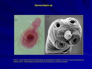 Hymenolepis sp
http://workforce.cup.edu/Buckelew/images/Hymenole
pis%20diminuta%20cysticercoid.jpg
http://www.stanford.edu/class/humbio103/ParaSites2002/hymenolepisi/
microstoma.scolex_semp.gif
1
2
A B
1
2
Foto A – larva cisticercóide de Hymenolepis sp,apresentando escólex (1) e com um pouco de líquido do
interior (2); B – Hymenolepis sp observa-se as 4 ventosas e a coroa de acúleos.
 