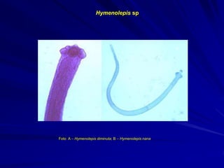 http://home.austarnet.com.au/wormman/paraimg
/hdimiscp.jpg
http://www.parasitologia.uchile.cl/apuntes_de_clases/_PRIVATE
/TecMedBasico/tablas/Imagenes%20tablas/himenolepis_adulto.j
pg
Foto A – Hymenolepis diminuta; B – Hymenolepis nana
A B
Hymenolepis sp
 