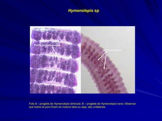 Poros genitais
Poros genitais
http://home.austarnet.com.au/wormman/paraimg/hd
imiscp.jpg
http://www.atlas.or.kr/donation/donation_files/2_15.jpg
Foto A – proglote de Hymenolepis diminuta; B – proglote de Hymenolepis nana .Observar
que todos os poro ficam do mesmo lado,ou seja, são unilaterais.
A B
Hymenolepis sp
 