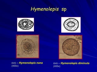 Hymenolepis sp
ovo – Hymenolepis nana
(400x)
ovo – Hymenolepis diminuta
(400x)
 