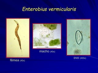 Enterobius vermicularis
fêmea (40x)
macho (40x)
ovo (400x)
 