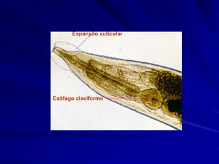 Esôfago claviforme
Expansão cuticular
 