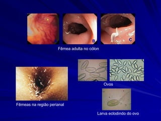 A C
B
Fêmea adulta no cólon
Fêmeas na região perianal
Larva eclodindo do ovo
Ovos
 