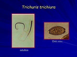 Trichuris trichiura
adultos
Ovo (400x)
 