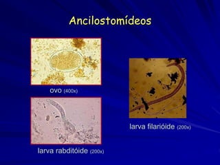 Ancilostomídeos
ovo (400x)
larva rabditóide (200x)
larva filarióide (200x)
 