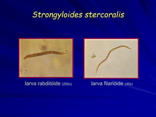 Strongyloides stercoralis
larva rabditóide (200x) larva filarióide (40x)
 