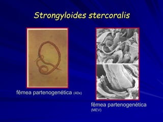 Strongyloides stercoralis
fêmea partenogenética (40x)
fêmea partenogenética
(MEV)
 
