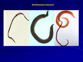 http://upload.wikimedia.org/wikipedia/commons/thum
b/4/4c/5252_lores_SchistosomaMansoni.jpg
http://pathmicro.med.sc.edu/patasitology/smansmf.ipg http://unibielefeld.de/biologie/Didaktik/7oologie/html
_deutsch/pics/Schistosoma_mansoni_paar.jpg
A B C
macho
fêmea
Schistosoma mansoni
 