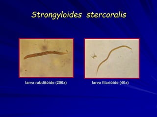 Strongyloides stercoralis
larva rabditóide (200x) larva filarióide (40x)
 