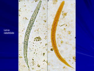 L1 S steroralis
Larva
rabditóide
 