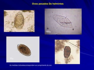 Ovos pesados De helmintos
As medidas indicadascorrespondem ao comprimento do ovo
180
90
180
10
 
