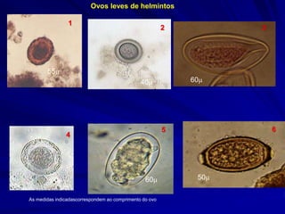 55
Ovos leves de helmintos
As medidas indicadascorrespondem ao comprimento do ovo
55
40 60
50 50
60
1
2 3
4
5 6
 