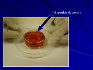 Superfície de contato
 
