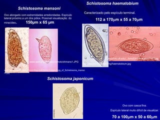 Schistosoma mansoni
Schistosoma haematobium
Ovo alongado com extremidades arredondadas. Espículo
lateral próximo a um dos pólos. Possível visualização do
miracídeo. 150µm x 65 µm
Caracterizado pelo espículo terminal.
112 a 170m x 55 a 70m
www.asm.org/Division/c/photo/shmans1.JPG
www.aarogya.com/conditions/diagnostictests/images/Egg_of_Schistosona_manso
ni.jpg
www.zepper.ru/parazit/img/haematobium.jpg
medinfo.ufl.edu/.../bms5300/images/d7192.jpg
Ovo com casca fina.
Espículo lateral muito difícil de visualizar.
70 a 100m x 50 a 60m
Schistosoma japonicum
 