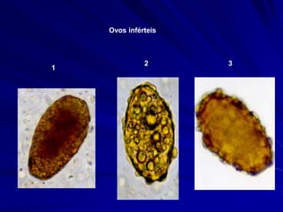 Ovos inférteis
1
2 3
 