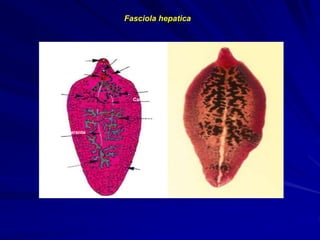 Ventosa oral
Ventosa ventral
Poro genital
Intestino ciego
utero
Canal de laurer
Testículo
ovario
Conducto eferente
testículo
Glândulas
vifelôgenas
http://www.ucm.es/info/parasito/Fasciola.jpg http://www.wormboss.com.au/images/content/fasciola.jpg
Foto A – Fasciola hapatica desenhada; B – Fasciola hepatica vista no microscópio
Fasciola hepatica
 