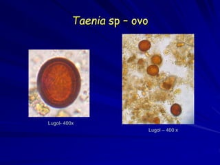 Taenia sp – ovo
Lugol- 400x
Lugol – 400 x
 