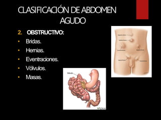CLASIFICACIÓNDEABDOMEN
AGUDO
2. OBSTRUCTIVO:
• Bridas.
• Hernias.
• Eventraciones.
• Vólvulos.
• Masas.
 