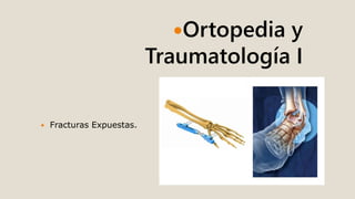 Ortopedia y
Traumatología I
 Fracturas Expuestas.
 