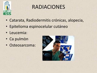 RADIACIONES
• Catarata, Radiodermitis crónicas, alopecia,
• Epitelioma espinocelular cutáneo
• Leucemia:
• Ca pulmòn
• Osteosarcoma:
 