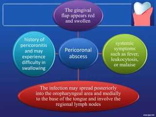 Pericoronal
abscess
The infection may spread posteriorly
into the oropharyngeal area and medially
to the base of the tongue and involve the
regional lymph nodes
systemic
symptoms
such as fever,
leukocytosis,
or malaise
The gingival
flap appears red
and swollen
history of
pericoronitis
and may
experience
difficulty in
swallowing
 