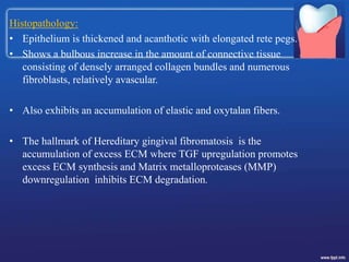 Histopathology:
• Epithelium is thickened and acanthotic with elongated rete pegs.
• Shows a bulbous increase in the amount of connective tissue
consisting of densely arranged collagen bundles and numerous
fibroblasts, relatively avascular.
• Also exhibits an accumulation of elastic and oxytalan fibers.
• The hallmark of Hereditary gingival fibromatosis is the
accumulation of excess ECM where TGF upregulation promotes
excess ECM synthesis and Matrix metalloproteases (MMP)
downregulation inhibits ECM degradation.
 