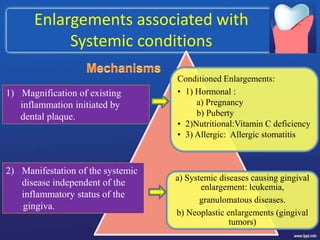 Enlargements associated with
Systemic conditions
Conditioned Enlargements:
• 1) Hormonal :
a) Pregnancy
b) Puberty
• 2)Nutritional:Vitamin C deficiency
• 3) Allergic: Allergic stomatitis
a) Systemic diseases causing gingival
enlargement: leukemia,
granulomatous diseases.
b) Neoplastic enlargements (gingival
tumors)
1) Magnification of existing
inflammation initiated by
dental plaque.
2) Manifestation of the systemic
disease independent of the
inflammatory status of the
gingiva.
 