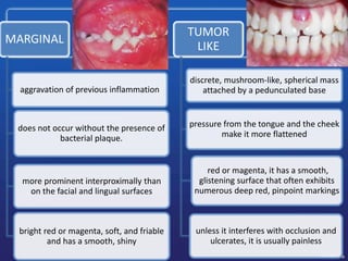 MARGINAL
aggravation of previous inflammation
does not occur without the presence of
bacterial plaque.
more prominent interproximally than
on the facial and lingual surfaces
bright red or magenta, soft, and friable
and has a smooth, shiny
TUMOR
LIKE
discrete, mushroom-like, spherical mass
attached by a pedunculated base
pressure from the tongue and the cheek
make it more flattened
red or magenta, it has a smooth,
glistening surface that often exhibits
numerous deep red, pinpoint markings
unless it interferes with occlusion and
ulcerates, it is usually painless
 