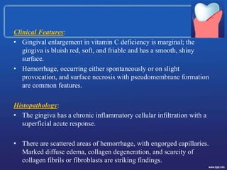 Clinical Features:
• Gingival enlargement in vitamin C deficiency is marginal; the
gingiva is bluish red, soft, and friable and has a smooth, shiny
surface.
• Hemorrhage, occurring either spontaneously or on slight
provocation, and surface necrosis with pseudomembrane formation
are common features.
Histopathology:
• The gingiva has a chronic inflammatory cellular infiltration with a
superficial acute response.
• There are scattered areas of hemorrhage, with engorged capillaries.
Marked diffuse edema, collagen degeneration, and scarcity of
collagen fibrils or fibroblasts are striking findings.
 