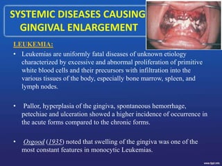 SYSTEMIC DISEASES CAUSING
GINGIVAL ENLARGEMENT
LEUKEMIA:
• Leukemias are uniformly fatal diseases of unknown etiology
characterized by excessive and abnormal proliferation of primitive
white blood cells and their precursors with infiltration into the
various tissues of the body, especially bone marrow, spleen, and
lymph nodes.
• Pallor, hyperplasia of the gingiva, spontaneous hemorrhage,
petechiae and ulceration showed a higher incidence of occurrence in
the acute forms compared to the chronic forms.
• Osgood (1935) noted that swelling of the gingiva was one of the
most constant features in monocytic Leukemias.
 