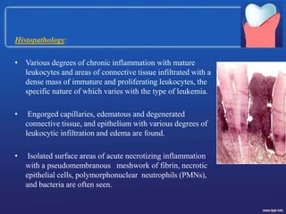 Histopathology:
• Various degrees of chronic inflammation with mature
leukocytes and areas of connective tissue infiltrated with a
dense mass of immature and proliferating leukocytes, the
specific nature of which varies with the type of leukemia.
• Engorged capillaries, edematous and degenerated
connective tissue, and epithelium with various degrees of
leukocytic infiltration and edema are found.
• Isolated surface areas of acute necrotizing inflammation
with a pseudomembranous meshwork of fibrin, necrotic
epithelial cells, polymorphonuclear neutrophils (PMNs),
and bacteria are often seen.
 