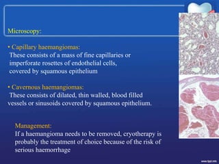 Microscopy:
• Capillary haemangiomas:
These consists of a mass of fine capillaries or
imperforate rosettes of endothelial cells,
covered by squamous epithelium
• Cavernous haemangiomas:
These consists of dilated, thin walled, blood filled
vessels or sinusoids covered by squamous epithelium.
Management:
If a haemangioma needs to be removed, cryotherapy is
probably the treatment of choice because of the risk of
serious haemorrhage
 