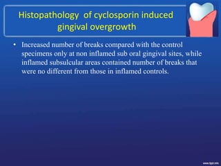 Histopathology of cyclosporin induced
gingival overgrowth
• Increased number of breaks compared with the control
specimens only at non inflamed sub oral gingival sites, while
inflamed subsulcular areas contained number of breaks that
were no different from those in inflamed controls.
 