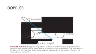 DOPPLER
• 10.37
 