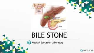 Medical Education Laboratory
BILE STONE
 