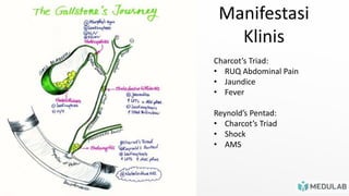 Manifestasi
Klinis
Charcot’s Triad:
• RUQ Abdominal Pain
• Jaundice
• Fever
Reynold’s Pentad:
• Charcot’s Triad
• Shock
• AMS
 