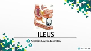 Medical Education Laboratory
ILEUS
 