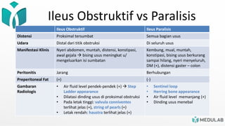 Ileus Obstruktif vs Paralisis
Ileus Obstruktif Ileus Paralisis
Distensi Proksimal tersumbat Semua bagian usus
Udara Distal dari titik obstruksi Di seluruh usus
Manifestasi Klinis Nyeri abdomen, muntah, distensi, konstipasi,
awal gejala  bising usus meningkat u/
mengeluarkan isi sumbatan
Kembung, mual, muntah,
konstipasi, bising usus berkurang
sampai hilang, nyeri menyeluruh,
DM (+), distensi gaster – colon
Peritonitis Jarang Berhubungan
Preperitoneal Fat (+) (-)
Gambaran
Radiologis
• Air fluid level pendek-pendek (+)  Step
Ladder appearance
• Dilatasi dinding usus di proksimal obstruksi
• Pada letak tinggi: valvula conniventes
terlihat jelas (+), string of pearls (+)
• Letak rendah: haustra terlihat jelas (+)
• Sentinel loop
• Herring bone appearance
• Air fluid level memanjang (+)
• Dinding usus menebal
 